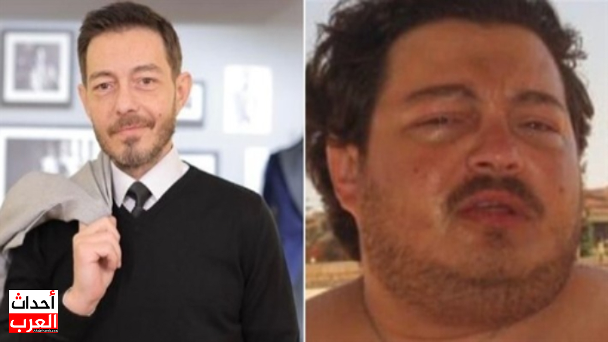 احمد زاهر قبل وبعد.. صور صادمة! احمد زاهر قبل وبعد.. صور صادمة!