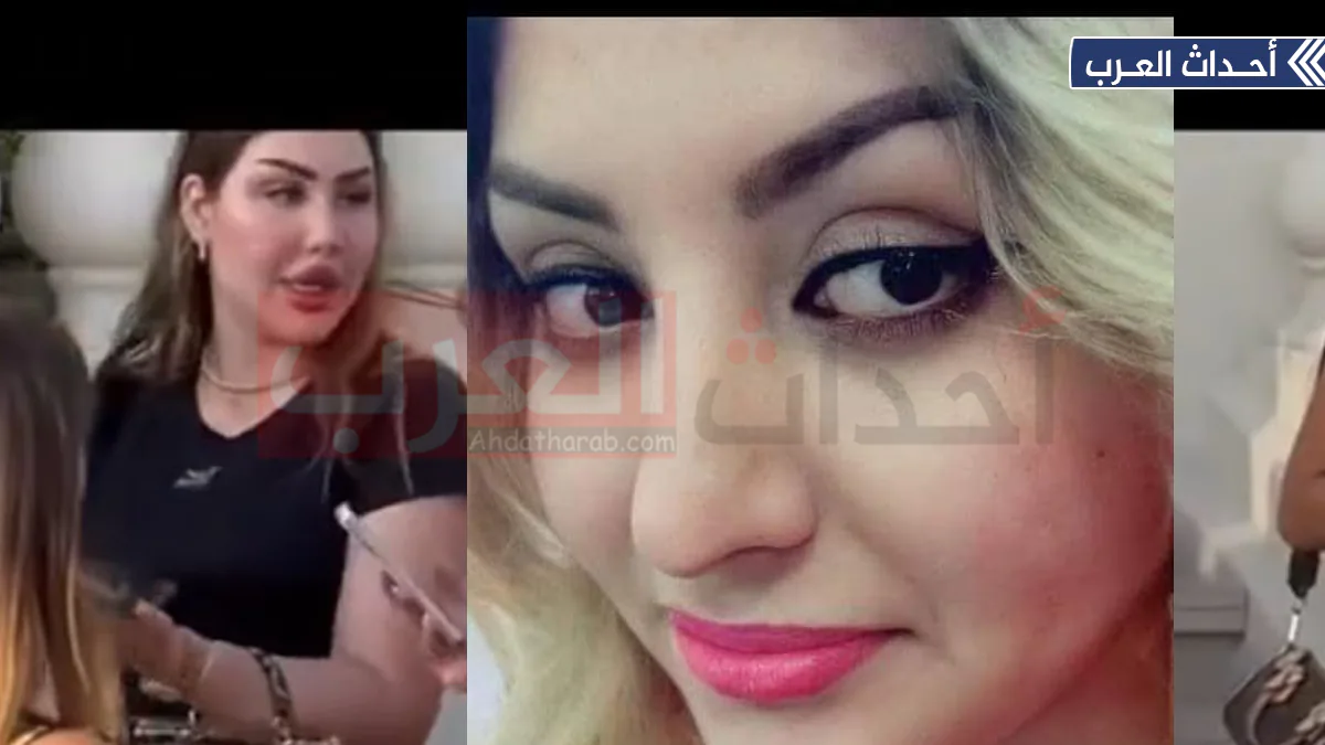 حنين الكبيسي قبل التجميل