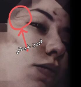 الدكتورة بان زياد طارق: قضية مدروسة ومخططة! قرون شيطان
